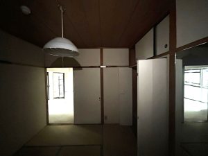 Before②